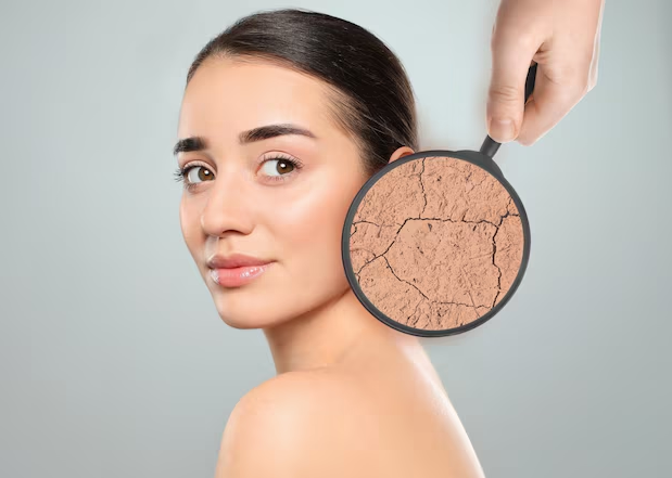 Kış Aylarında Cilt Kuruluğuna Karşı Alınabilecek Önlemler 2